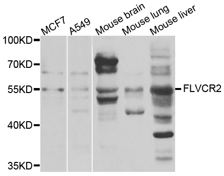 FLVCR2 Antibody - Western blot analysis of extracts of various cells.