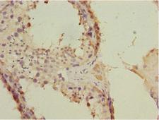FLVCR2 Antibody - Immunohistochemistry of paraffin-embedded human testis tissue at dilution 1:100