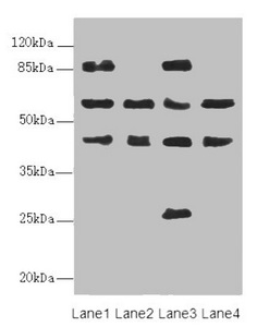 FLVCR2 Antibody - Western blot All Lanes:FLVCR2 antibody at 0.89ug/ml Lane 1 : MCF7 whole cell lysate Lane 2 : A549 whole cell lysate Lane 3 : Mouse lung tissue Lane 4 : Mouse liver tissue Secondary Goat polyclonal to Rabbit IgG at 1/10000 dilution Predicted band size: 58,36 kDa Observed band size: 57,86,45,26 kDa