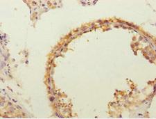 FLVCR2 Antibody - Immunohistochemistry of paraffin-embedded human testis tissue at dilution 1:100