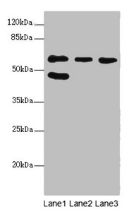 FLVCR2 Antibody - Western blot All Lanes:FLVCR2 antibody at 0.83ug/ml Lane 1 : MCF7 whole cell lysate Lane 2 : A549 whole cell lysate Lane 3 : Mouse lung tissue Secondary Goat polyclonal to Rabbit IgG at 1/10000 dilution Predicted band size: 58,36 kDa Observed band size: 57,45 kDa