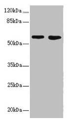 FLVCR2 Antibody - Western blot All lanes: FLVCR2 antibody at 0.83µg/ml Lane 1: A549 whole cell lysate Lane 2: Mouse lung tissue Secondary Goat polyclonal to rabbit IgG at 1/10000 dilution Predicted band size: 58, 36 kDa Observed band size: 58 kDa