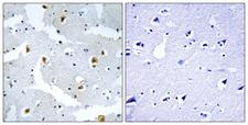 FMN2 / Formin 2 Antibody - Immunohistochemistry analysis of paraffin-embedded human brain tissue, using FMN2 Antibody. The picture on the right is blocked with the synthesized peptide.