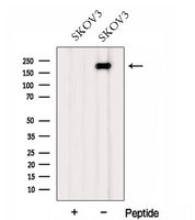 FMN2 / Formin 2 Antibody - Western blot analysis of extracts of SK-OV3 cells using FMN2 antibody. The lane on the left was treated with blocking peptide.