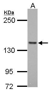 FMNL1 Antibody - Sample (30 ug of whole cell lysate). A: Raji. 5% SDS PAGE. FMNL1 antibody diluted at 1:1000.