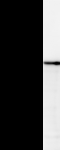 FMNL1 Antibody - Detection of human FMNL1 by Western blot. Samples: Whole cell lysate (25 ug) from HeLa cells. Predicted molecular weight: 121 kDa
