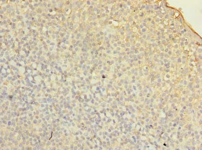 FMNL1 Antibody - Immunohistochemistry of paraffin-embedded human tonsil tissue using FMNL1 Antibody at dilution of 1:100