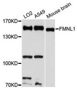 FMNL1 Antibody - Western blot analysis of extracts of various cell lines, using FMNL1 antibody at 1:3000 dilution. The secondary antibody used was an HRP Goat Anti-Rabbit IgG (H+L) at 1:10000 dilution. Lysates were loaded 25ug per lane and 3% nonfat dry milk in TBST was used for blocking. An ECL Kit was used for detection and the exposure time was 90s.