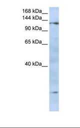 FMNL2 Antibody - Jurkat cell lysate. Antibody concentration: 1.0 ug/ml. Gel concentration: 6-18%.  This image was taken for the unconjugated form of this product. Other forms have not been tested.