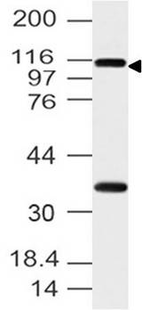 FMNL3 Antibody - Fig-1: Western blot analysis of FMNL3. Anti-FMNL3 antibody was used at 4 µg/ml on h Stomach lysate.