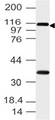 FMNL3 Antibody - Fig-1: Western blot analysis of FMNL3. Anti-FMNL3 antibody was used at 4 µg/ml on h Stomach lysate.