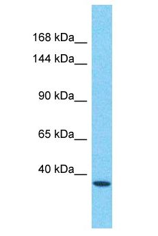 FMNL3 Antibody - FMNL3 antibody Western Blot of 721_B. Antibody dilution: 1 ug/ml.  This image was taken for the unconjugated form of this product. Other forms have not been tested.
