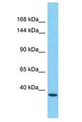 FMNL3 Antibody - FMNL3 antibody Western Blot of 721_B. Antibody dilution: 1 ug/ml.  This image was taken for the unconjugated form of this product. Other forms have not been tested.