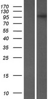 FMNL3 Protein - Western validation with an anti-DDK antibody * L: Control HEK293 lysate R: Over-expression lysate