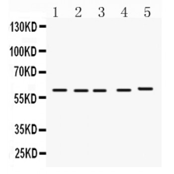 FMO1 Antibody - FMO1 antibody Western blot. All lanes: Anti FMO1 at 0.5 ug/ml. Lane 1: Rat Liver Tissue Lysate at 50 ug. Lane 2: Mouse Liver Tissue Lysate at 50 ug. Lane 3: Rat Kidney Tissue Lysate at 50 ug. Lane 4: Mouse Kidney Tissue Lysate at 50 ug. Lane 5: SMMC Whole Cell Lysate at 40 ug. Predicted band size: 60 kD. Observed band size: 60 kD.