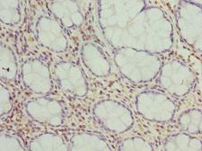 FMO1 Antibody - Immunohistochemistry of paraffin-embedded human colon cancer at dilution 1:100