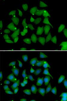 FMO1 Antibody - Immunofluorescence analysis of HeLa cells using FMO1 Polyclonal Antibody.