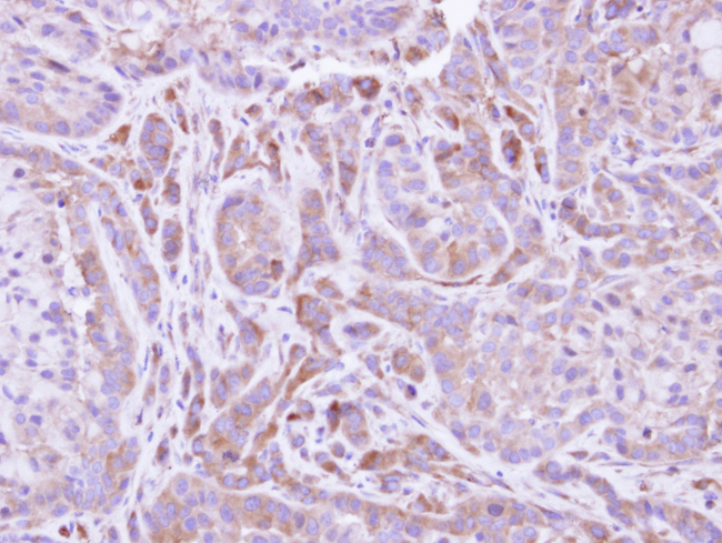 FMO2 Antibody - IHC of paraffin-embedded A549 xenograft using FMO2 antibody at 1:500 dilution.