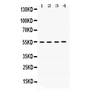 FMO2 Antibody - FMO2 antibody Western blot. All lanes: Anti FMO2 at 0.5 ug/ml. Lane 1: A549 Whole Cell Lysate at 40 ug. Lane 2: HELA Whole Cell Lysate at 40 ug. Lane 3: MCF-7 Whole Cell Lysate at 40 ug. Lane 4: SW620 Whole Cell Lysate at 40 ug. Predicted band size: 54 kD. Observed band size: 54 kD.