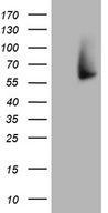 FMO3 Antibody - HEK293T cells were transfected with the pCMV6-ENTRY control. (Left lane) or pCMV6-ENTRY FMO3. (Right lane) cDNA for 48 hrs and lysed. Equivalent amounts of cell lysates. (5 ug per lane) were separated by SDS-PAGE and immunoblotted with anti-FMO3. (1:500)