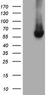 FMO3 Antibody - HEK293T cells were transfected with the pCMV6-ENTRY control. (Left lane) or pCMV6-ENTRY FMO3. (Right lane) cDNA for 48 hrs and lysed. Equivalent amounts of cell lysates. (5 ug per lane) were separated by SDS-PAGE and immunoblotted with anti-FMO3. (1:500)