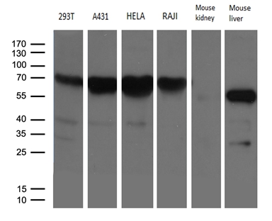 FMO3 Antibody - Western blot analysis of extracts. (35ug) from 4 different cell lines and 2 different tissue lysates by using anti-FMO3 monoclonal antibody. (1:500)