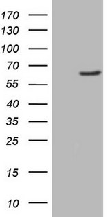 FMO3 Antibody - HEK293T cells were transfected with the pCMV6-ENTRY control (Left lane) or pCMV6-ENTRY FMO3 (Right lane) cDNA for 48 hrs and lysed. Equivalent amounts of cell lysates (5 ug per lane) were separated by SDS-PAGE and immunoblotted with anti-FMO3 (1:2000).