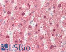 FMO3 Antibody - Human, Liver: Formalin-Fixed Paraffin-Embedded (FFPE).  This image was taken for the unconjugated form of this product. Other forms have not been tested.