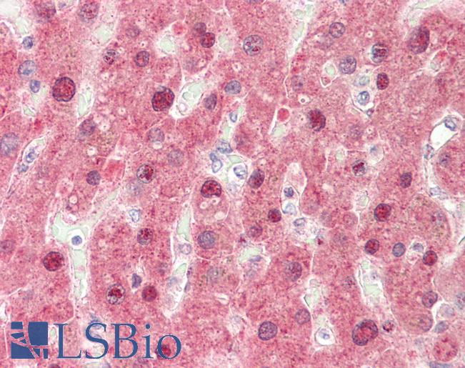 FMO3 Antibody - Human, Liver: Formalin-Fixed Paraffin-Embedded (FFPE).  This image was taken for the unconjugated form of this product. Other forms have not been tested.