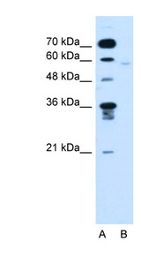 FMO3 Antibody - FMO3 antibody Western blot of Jurkat lysate.  This image was taken for the unconjugated form of this product. Other forms have not been tested.