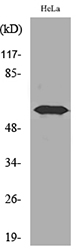 FMO3 Antibody - Western blot analysis of lysate from HeLa cells, using FMO3 Antibody.
