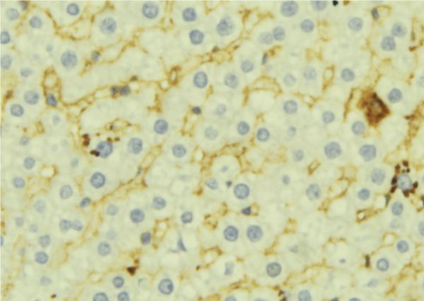 FMO3 Antibody - 1:100 staining mouse liver tissue by IHC-P. The sample was formaldehyde fixed and a heat mediated antigen retrieval step in citrate buffer was performed. The sample was then blocked and incubated with the antibody for 1.5 hours at 22°C. An HRP conjugated goat anti-rabbit antibody was used as the secondary.