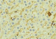 FMO3 Antibody - 1:100 staining mouse liver tissue by IHC-P. The sample was formaldehyde fixed and a heat mediated antigen retrieval step in citrate buffer was performed. The sample was then blocked and incubated with the antibody for 1.5 hours at 22°C. An HRP conjugated goat anti-rabbit antibody was used as the secondary.