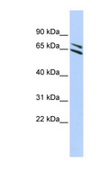 FMO4 Antibody - FMO4 antibody Western blot of HepG2 cell lysate. This image was taken for the unconjugated form of this product. Other forms have not been tested.