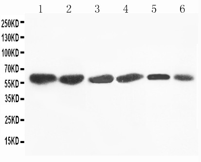 FMO4 Antibody - WB of FMO4 antibody. All lanes: Anti-FMO4 at 0.5ug/ml. Lane 1: Rat Liver Tissue Lysate at 40ug. Lane 2: Mouse Liver Tissue Lysate at 40ug. Lane 3: SMMC Whole Cell Lysate at 40ug. Lane 4: HEPA Whole Cell Lysate at 40ug. Lane 5: A431 Whole Cell Lysate at 40ug. Lane 6: MCF-7 Whole Cell Lysate at 40ug. Predicted bind size: 63KD. Observed bind size: 63KD.