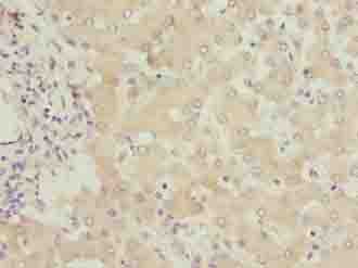 FMO4 Antibody - Immunohistochemistry of paraffin-embedded human liver tissue using antibody at dilution of 1:100.