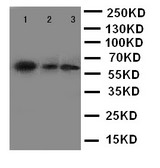 FMO5 Antibody - WB of FMO5 antibody. Lane 1: Mouse Liver Tissue Lysate. Lane 2: Mouse Testis Tissue Lysate. Lane 3: Mouse Spleen Tissue Lysate..