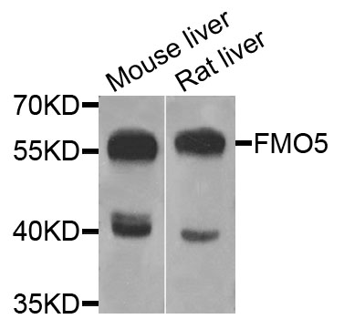 FMO5 Antibody - Western blot analysis of extracts of various cells.