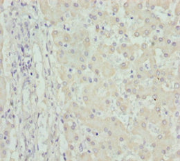 FMO5 Antibody - Immunohistochemistry of paraffin-embedded human liver tissue at dilution 1:100