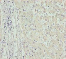 FMO5 Antibody - Immunohistochemistry of paraffin-embedded human liver tissue at dilution 1:100