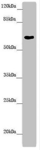 FMO5 Antibody - Western blot All Lanes:FMO5 antibody at 6.04 ug/ml +Mouse liver tissue Secondary Goat polyclonal to rabbit IgG at 1/10000 dilution Predicted band size: 61,33,53 kDa Observed band size: 60 kDa
