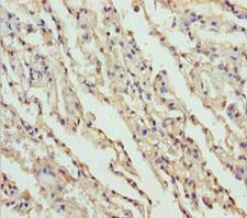 FMO5 Antibody - Immunohistochemistry of paraffin-embedded human lung tissue at dilution 1:100