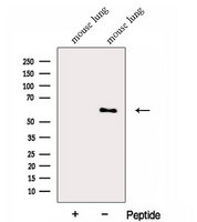 FMO5 Antibody - Western blot analysis of extracts of mouse lung tissue using FMO5 antibody. The lane on the left was treated with blocking peptide.