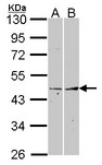 FMOD / Fibromodulin Antibody - Sample (30 ug of whole cell lysate). A: A431. B: Hela. 10% SDS PAGE. Fibromodulin antibody. FMOD antibody diluted at 1:1000. 