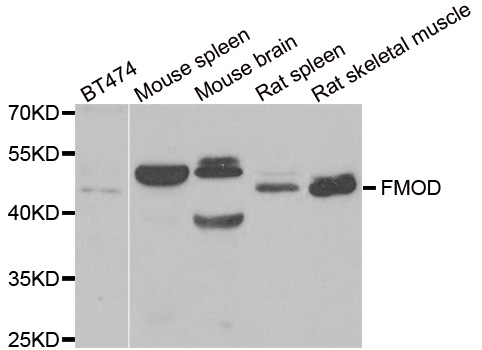 FMOD / Fibromodulin Antibody - Western blot analysis of extracts of various cell lines.
