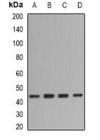 FMOD / Fibromodulin Antibody - Western blot analysis of Fibromodulin expression in BT474 (A); mouse spleen (B); mouse brain (C); rat spleen (D) whole cell lysates.