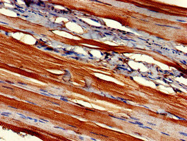 FMOD / Fibromodulin Antibody - Immunohistochemistry of paraffin-embedded human skeletal muscle tissue at dilution of 1:100
