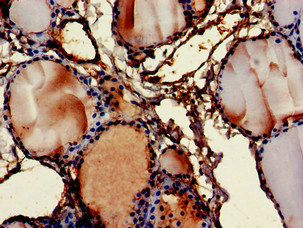 FMOD / Fibromodulin Antibody - Immunohistochemistry of paraffin-embedded human thyroid tissue at dilution of 1:100