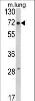 FMR1 / FMRP Antibody - Western blot of FMR1 Antibody in mouse lung tissue lysates (35 ug/lane). FMR1 (arrow) was detected using the purified antibody.