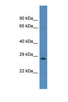 FMR1 / FMRP Antibody - Western blot of Human PANC1. FMR1 antibody dilution 1.0 ug/ml.  This image was taken for the unconjugated form of this product. Other forms have not been tested.